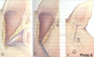 Chirurgie de l<span data-charcode=