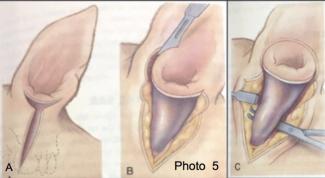 Chirurgie de l<span data-charcode=