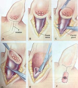 Chirurgie de l<span data-charcode=