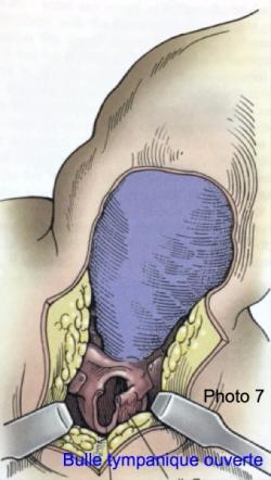 Chirurgie de l<span data-charcode=