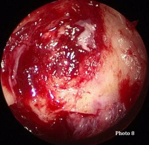 Chirurgie de l<span data-charcode=