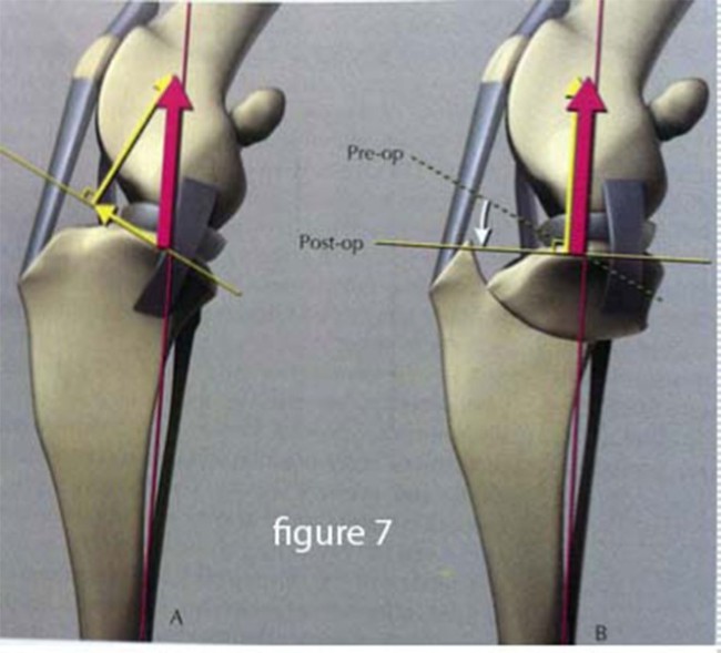 Déchirure du ligament croisé crânial du chien Neuilly-sur-Seine, Paris