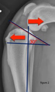 Déchirure du ligament croisé crânial du chien Neuilly-sur-Seine, Paris