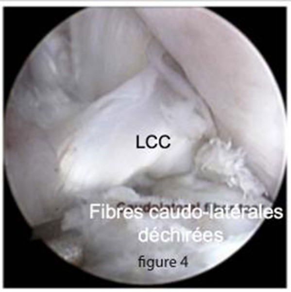 Déchirure du ligament croisé crânial du chien Neuilly-sur-Seine, Paris