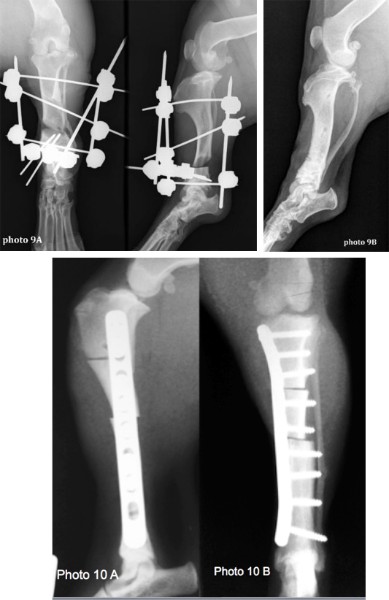 Chirurgie correctrice : déformation de croissance & pes varus