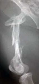 Fractures de l<span data-charcode=