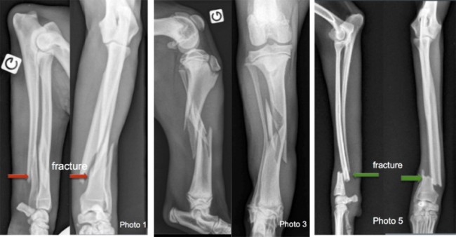 Fractures de l<span data-charcode=