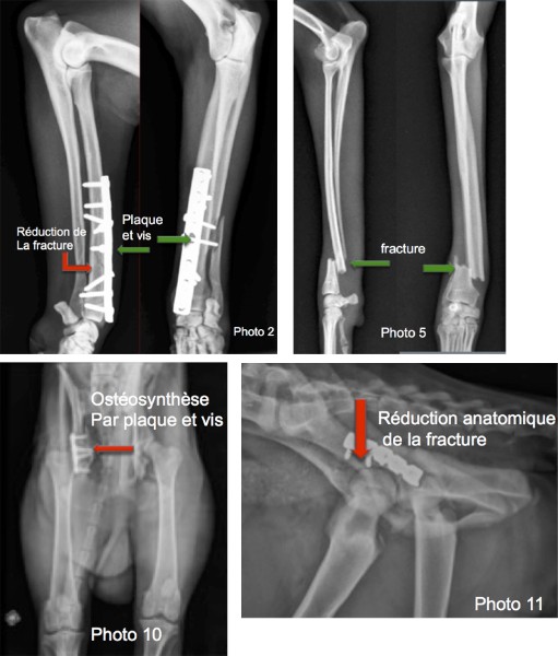 Fractures de l<span data-charcode=