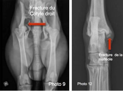 Fractures de l<span data-charcode=