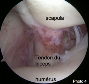 Maladie des tendons chez chien et le chat Neuilly-sur-Seine, Paris