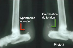 Maladie des tendons chez chien et le chat Neuilly-sur-Seine, Paris