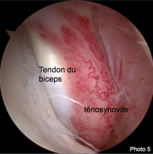 Maladie des tendons chez chien et le chat Neuilly-sur-Seine, Paris