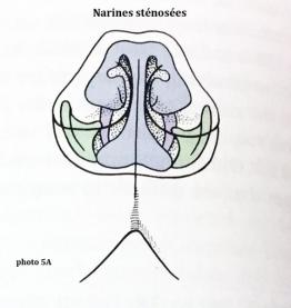 Le syndrome brachycéphale du chien Neuilly-sur-Seine, Paris