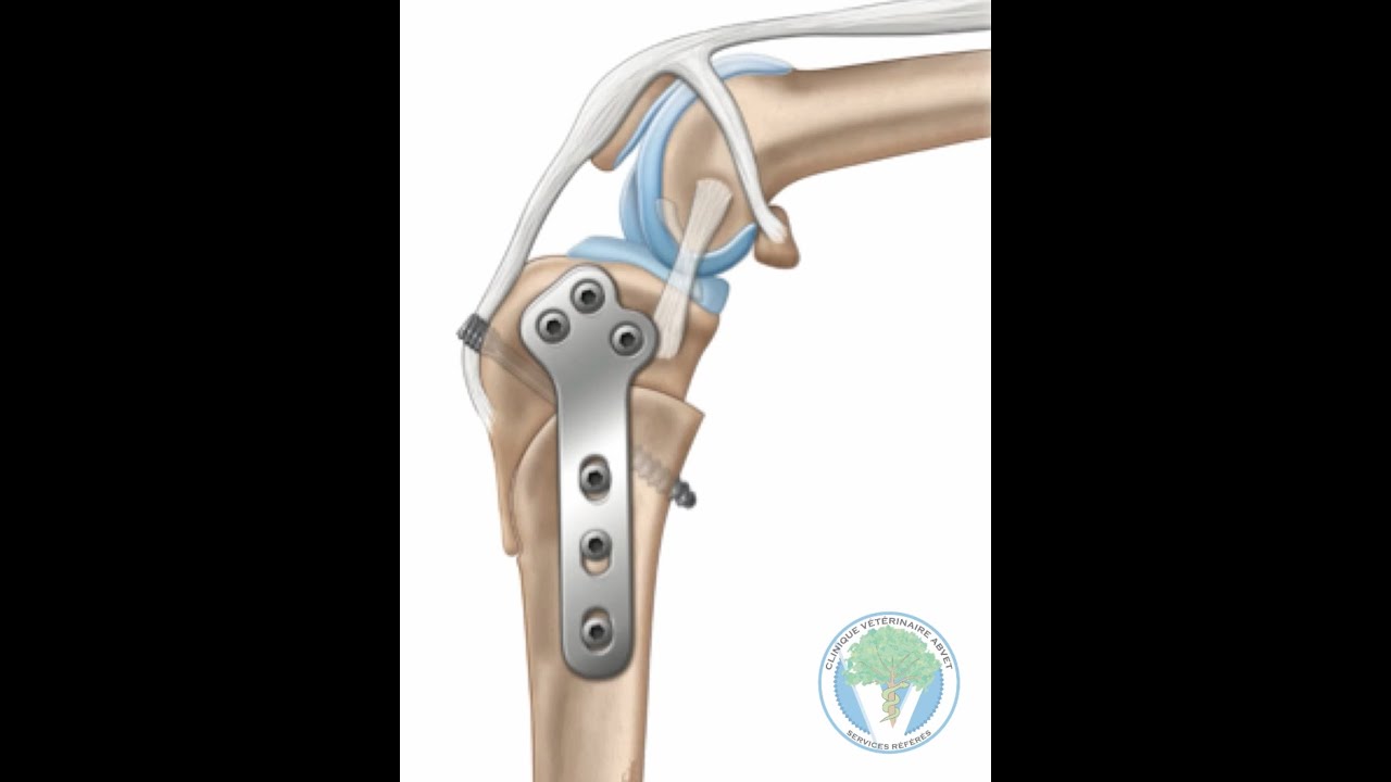 ligament croisé réparé